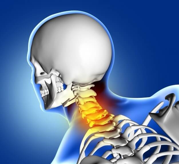 (Cervical Spondylosis)सर्वाइकल पेन लक्षण,कारण और बेहतर उपचार